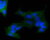 Photo for anti cc1 antibody