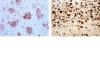 Photo for beta amyloid monoclonal antibody
