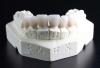 Photo for Ceramics Biomaterials Market Study By Type, Application & Top Key Players - Wright Medical Group, Inc., DePuy Orthopaedics, Inc., Invibio Ltd.