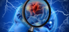 Photo for Global Deep Brain Stimulation Devices Market, By Application, and By Geography-Trends, Outlook,