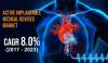 Photo for Active Implantable Medical Devices Market Opportunities by Types, Demand, Top Manufactures and Application in Grooming Regions