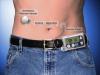 Photo for Global Artificial Pancreas Device System (APDS) Market Revenue Growth Predicted by 2024