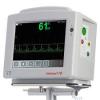Photo for Global Cardiac Monitors Market Trend, Marketing Channels, Major Industry Participants, Strategies  and Forecast To 2024