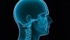 Photo for Craniomaxillofacial Devices Market Size, Share, Growth and Industry Research Report, 2019 to 2026
