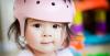 Photo for Global Pediatric Cranial Remolding Orthoses Market Manufacturers Sales Analysis Report 2019-2024