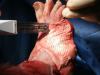 Photo for Soft Tissue Repair Market Size & Share | Industry Report To, 2025
