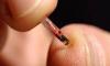 Photo for Biochips Market Report | Industry Size, Share and Forecast To, 2025