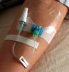 Photo for Catheter Stabilization Device Market Report From 2018 To 2025 - 3M Company, Braun Melsungen AG, Baxter International, Inc., C. R. Bard, Inc., Centurion Medical Products