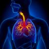 Photo for Gastroesophageal Reflux Disease Therapeutics Market Report | Industry Size, Share and Forecast To, 2025