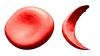 Photo for Hemoglobinopathy Treatment Market is Anticipated to Show Growth by 2027