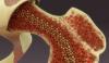 Photo for Musculoskeletal Oncology Therapeutics Market Report - Industry Size, Share, Trends, Growth And Forecast Till 2025