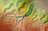 Photo for Helicobacter Pylori Diagnostics Market Progresses for Huge Growth to 2026 Envisage by Global Top Players