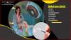 Photo for Medical Lasers Market Outlook, Share, Emerging Demand and Growth by 2023
