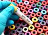 Photo for HPV Testing And Pap Test Market Report From 2018 To 2025 - Abbott Laboratories, Qiagen N.V., Roche Diagnostics, Hologic, Inc., Becton