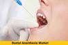 Photo for Global Dental Anesthesia Market Production, Sales, Consumption and Growth by 2023