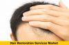 Photo for Worldwide Hair Restoration Services Market to Make Great Impact in Near Future by 2023