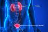 Photo for Bladder Cancer Therapeutics Market Analysis, Guidelines Overview and Upcoming Trends Forecast till 2026
