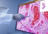 Photo for Digital Pathology Market Report | Industry Size and Leading Key Players - Leica Biosystems Nussloch GMBH, Ventana Medical Systems, Inc., Hamamatsu Photonics K.K.