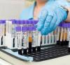 Photo for Sample Preparation Market Report From 2018 To 2025 Analysis By Top Company Profiles - Agilent Technologies, Inc., Bio-Rad Laboratories, Inc., Danaher Corporation, Hamilton Company, Illumina, Inc.