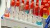 Photo for Cell Culture Media for Vaccine Market - Size, Share, Outlook, and Opportunity Analysis