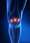 Photo for Knee Cartilage Repair Market - Global Industry Insights, Trends, Outlook,