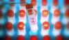 Photo for Stem Cell Banking Market To, 2025 Trends, Growth and Key Players - CBR Systems, Inc., Cordlife Group Ltd., Cryo-Cell International Inc., Cryo-Save AG, Lifecell
