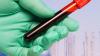 Photo for Liquid Biopsy Market Report From 2018 To 2025 Analysis By Top Company Profiles - Qiagen, Rarecells SAS, Silicon Biosystems, SRI International, Myriad Genetics