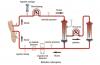 Photo for Therapeutic Plasma Exchange Market Report 2018-2025 By Top Players - Fresenius Se & Co. KGAA, B. Braun Melsungen AG, Baxter International Inc, Asahi Kasei Medical Co., Ltd.