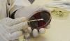 Photo for Enteric Disease Testing Market Size, Share, Growth, Trends and Forecast Report, 2018 to 2025
