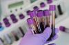 Photo for Blood Preparation Market Size, Share, Growth, Trends and Industry Analysis Report, 2019 to 2026