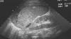 Photo for Global Ultrasound Market Manufacturers Sales Analysis Report 2019-2024