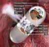 Photo for Capsule Endoscopy System Market Report To, 2025 Product Scope, Growth Rate & Industry Outlook