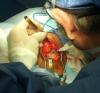 Photo for Electrosurgical Devices Market Size, Share, Growth and Trends, 2018 to 2025