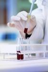 Photo for Acute Lymphocytic/Lymphoblastic Leukemia Therapeutics Market Size, Share, Growth, Trends and Industry Analysis Report