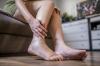 Photo for 10 Tips to Cope With Swelling That Actually Work