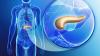 Photo for Exocrine Pancreatic Insufficiency Market Till 2025 Major Key Players are - Abbvie Inc., Allergan plc., Nordmark Arzneimittel GmbH & Co. KG, Digestive Care, Inc.