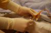 Photo for Pediatric Catheters Market Size, Share, Growth, Trends and Industry Research Report, 2019 to 2025