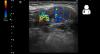 Photo for Ultrasound Image Analysis Software Market Size, Share, Growth and Trends Analysis Report, 2018 to 2025