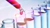 Photo for Stem cell therapy for Knee Pain and Chronic Diseases