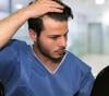 Photo for Hair Transplant In Islamabad