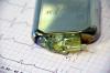 Photo for Pacemaker Market Size, Share, Growth, Trends and Industry Leaders Report