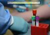 Photo for Genotyping Assay Market worth $31.9 billion by 2023