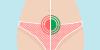 Photo for 4 Causes of Abdominal Pain During and After Sex