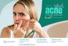 Photo for Results IPL Treatment for Acne Scars in Akron OH Dermatologist