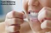 Photo for Global Teeth Whitening Products Market – Current Trends and Industry Overview, 2023