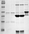 Photo for Molecular Weight Marker Market Size, Share, Growth, Trends and Forecast Report
