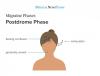 Photo for Postdrome Treatment