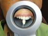 Photo for Dental Colorimeter Market Surge in Demand from Healthcare Industry to Boost Growth Forecast to 2026