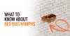 Photo for Bed Bug Treatment