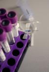 Photo for Hepatitis Diagnostic Test Market Size, Share, Growth and Trend Analysis Report